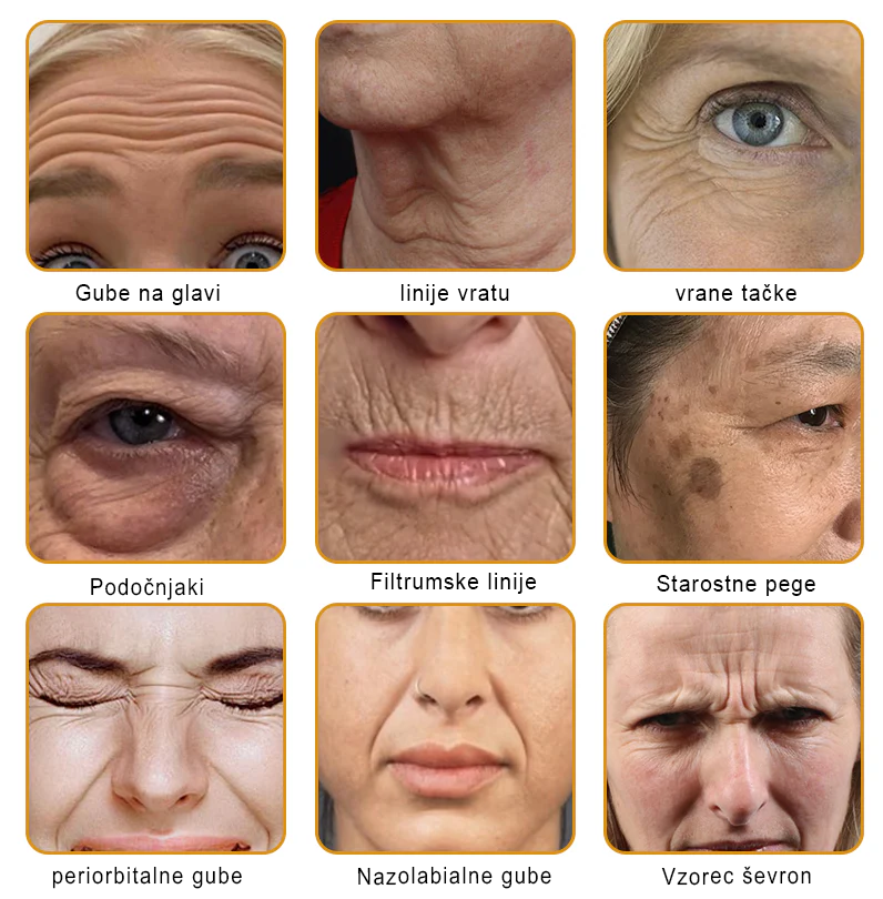 🌿🌿👨‍⚕Sinvie® Krema za obnovo kože z čebeljim strupom | 50 ml | Priporočeno dermatologov