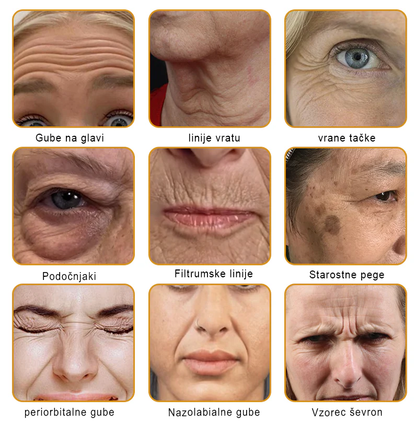 🌿🌿👨‍⚕Sinvie® Krema za obnovo kože z čebeljim strupom | 50 ml | Priporočeno dermatologov