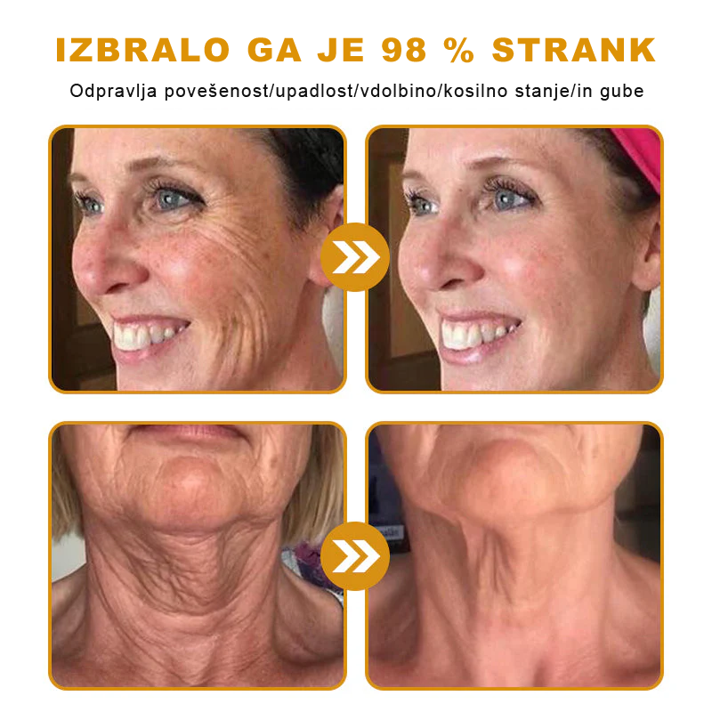 🌿🌿👨‍⚕Sinvie® Krema za obnovo kože z čebeljim strupom | 50 ml | Priporočeno dermatologov