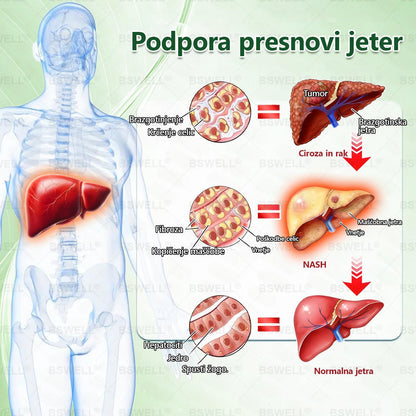 🌻🌻BSWELL® Nano mikroneedling shujševalni obliž (Samo enkrat na dan, vidne spremembe v 28 dneh)  ✅ Za debelost, zdravje srca in ožilja, sladkorno bolezen, spalno apnejo, zdravje črevesja, težave s sklepi in še več.