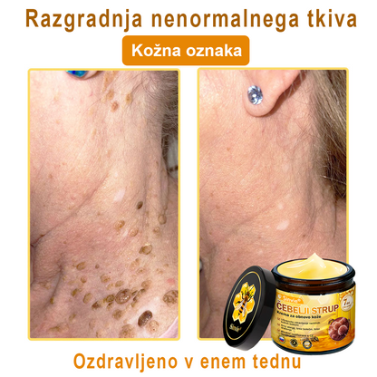 🌿🌿👨‍⚕Sinvie® Krema za obnovo kože z čebeljim strupom | 50 ml | Priporočeno dermatologov