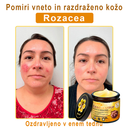 🌿🌿👨‍⚕Sinvie® Krema za obnovo kože z čebeljim strupom | 50 ml | Priporočeno dermatologov