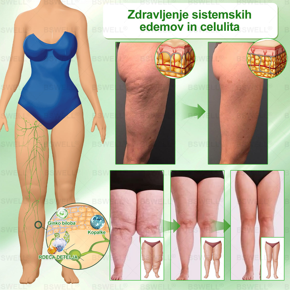 🌻🌻BSWELL® Nano mikroneedling shujševalni obliž (Samo enkrat na dan, vidne spremembe v 28 dneh)  ✅ Za debelost, zdravje srca in ožilja, sladkorno bolezen, spalno apnejo, zdravje črevesja, težave s sklepi in še več.