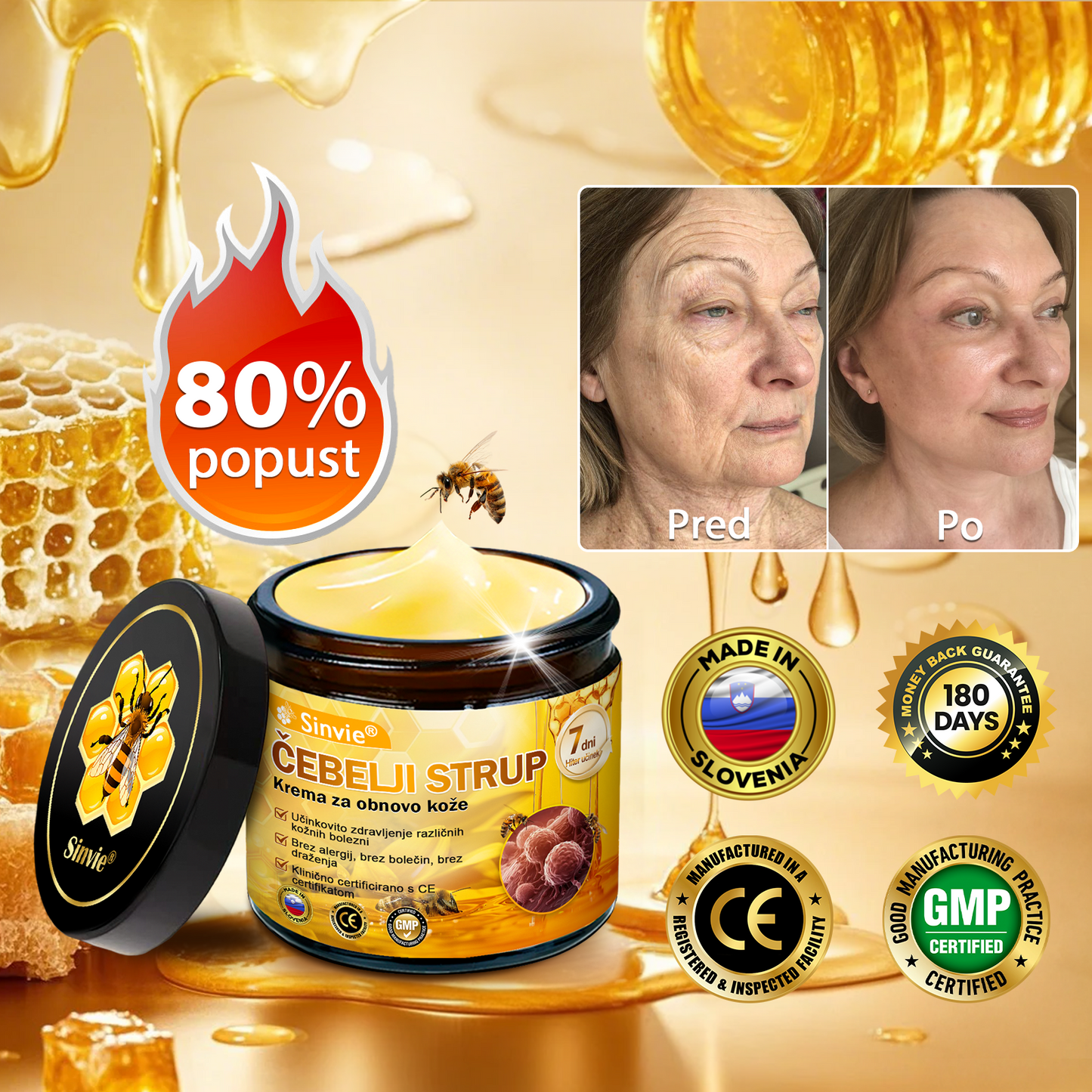 🌿🌿👨‍⚕Sinvie® Krema za obnovo kože z čebeljim strupom | 50 ml | Priporočeno dermatologov