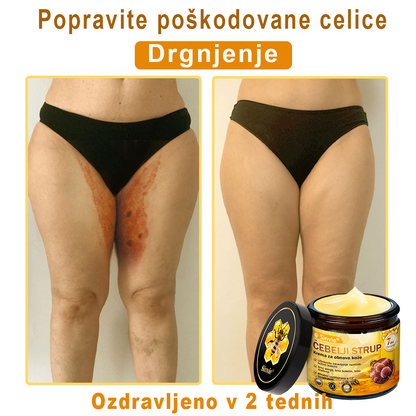 🌿🌿👨‍⚕Sinvie® Krema za obnovo kože z čebeljim strupom | 50 ml | Priporočeno dermatologov