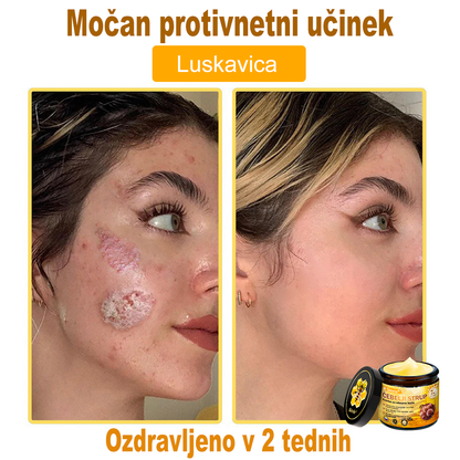 🌿🌿👨‍⚕Sinvie® Krema za obnovo kože z čebeljim strupom | 50 ml | Priporočeno dermatologov