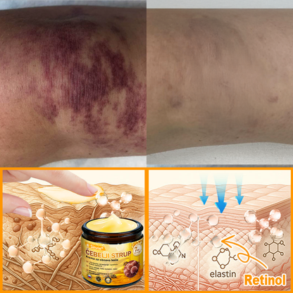 🌿🌿👨‍⚕Sinvie® Krema za obnovo kože z čebeljim strupom | 50 ml | Priporočeno dermatologov