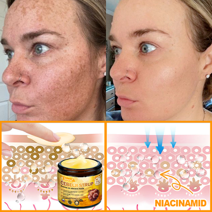 🌿🌿👨‍⚕Sinvie® Krema za obnovo kože z čebeljim strupom | 50 ml | Priporočeno dermatologov
