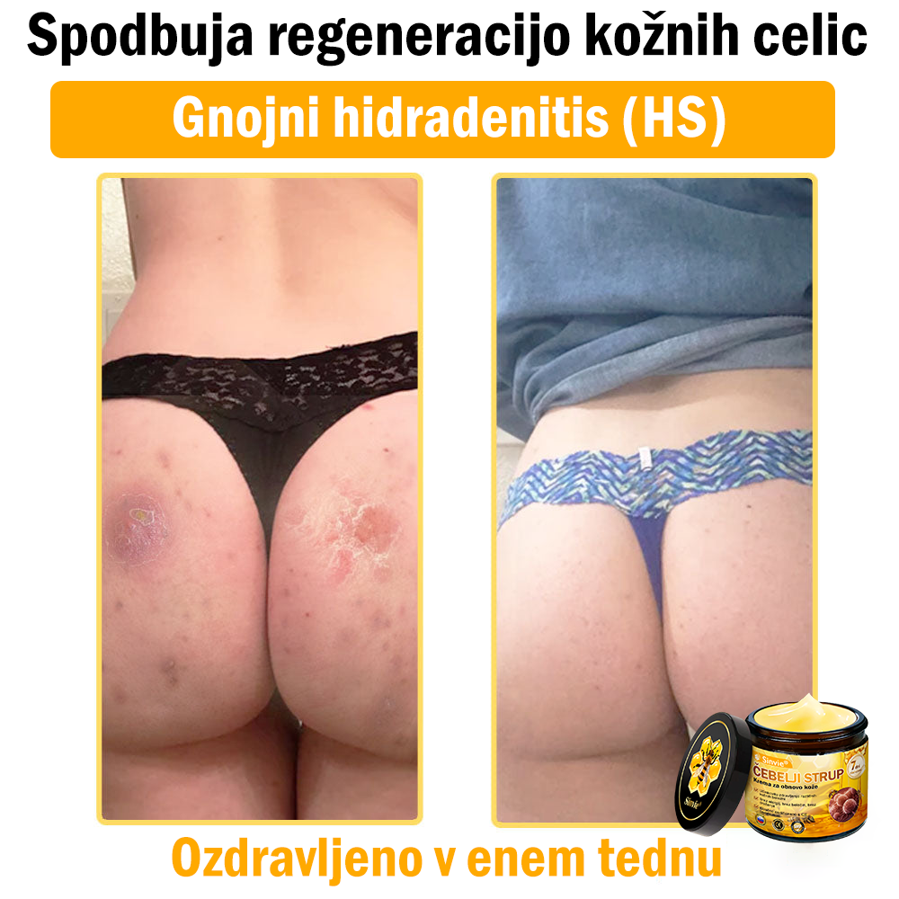 🌿🌿👨‍⚕Sinvie® Krema za obnovo kože z čebeljim strupom | 50 ml | Priporočeno dermatologov