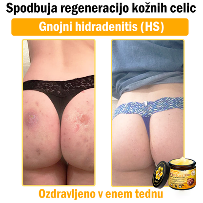 🌿🌿👨‍⚕Sinvie® Krema za obnovo kože z čebeljim strupom | 50 ml | Priporočeno dermatologov